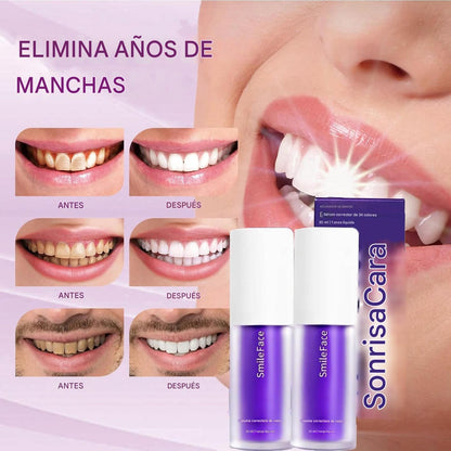 1 + 1 GRATIS | MAXWHITE™ — Dientes blancos en solo 11 días. Quita el color amarillento y las manchas que opacan tu sonrisa. (Incluye 2 pastas blanqueadoras + 2 lápices + 1 brillo natural para labios) *Ingredientes naturales **Especial Navidad