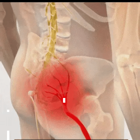 FlexiBack™ – El único cinturón cómodo y discreto que te permite volver a disfrutar de horas de pie sin dolor lumbar
